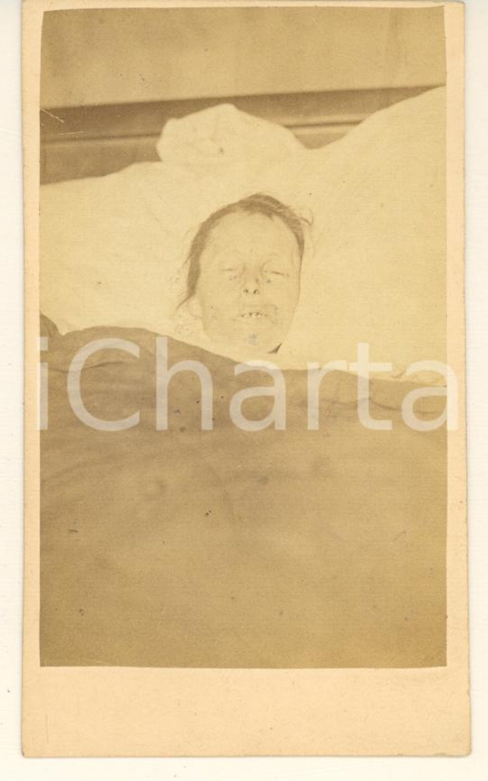 Fotografia d epoca originale 1876 s. l. Teresa LORETZ in ANDERBEGANI  Ritratto POST MORTEM Foto CDV 1