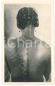 1930 ca C. ZAGOURSKI «L'Afrique qui disparaît» Femme Equateur - Scarification  Fotocartolina postale d'epoca, appartenente alla serie &laquo;L'Afrique qui dispara&icirc;t&raquo; del fotografo Casimir Zagourski (L&eacute;opoldville), n&deg; 37.Non viaggiata.Timbro al verso: "Henri Nicaise Photographe - Namur".CONDIZIONI: GFORMATO: 9x14 cm    originale e autentica 1