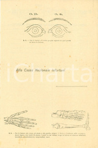 Documento originale, autentico 1935 ca MODENA Cassa Nazionale Assicurazione Infortuni Modulo ILLUSTRATO 1