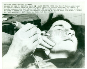Fotografia d epoca originale 1980 TORTONTO CANADA Dr. Robert NEWTON rimuove voglie con il laser Foto 1