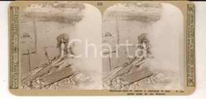 Fotografia d epoca originale 1918 WW1 THE GREAT WAR SOMME Stretcherbearers rescue a comrade Stereoscopic 1