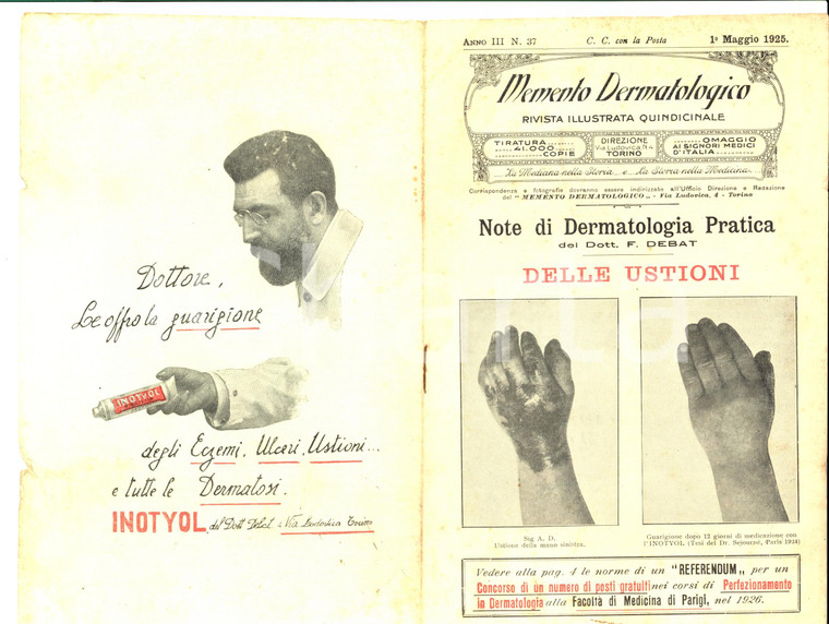 1925 TORINO Memento dermatologico - Dott. DEBAT Delle ustioni *Rivista