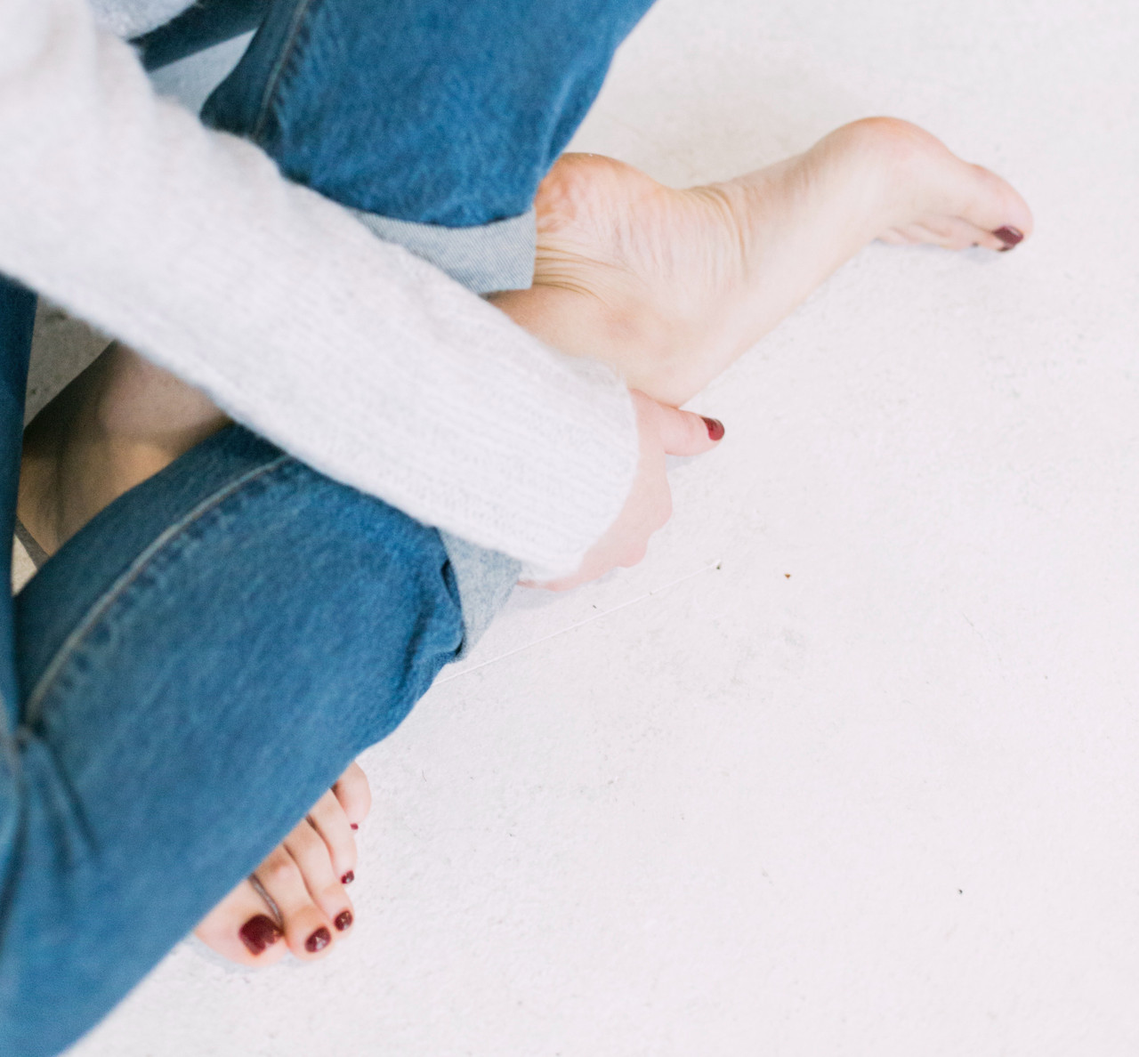 severe overpronation