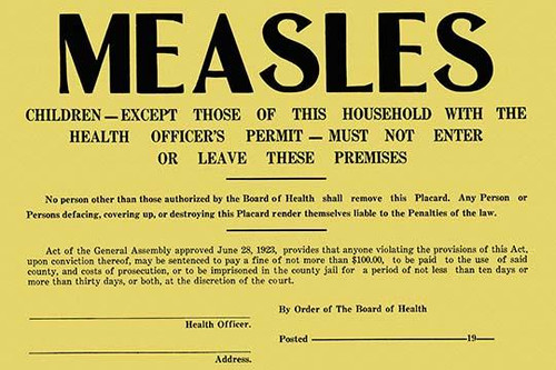 Measles