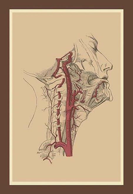 Internal Carotid Artery