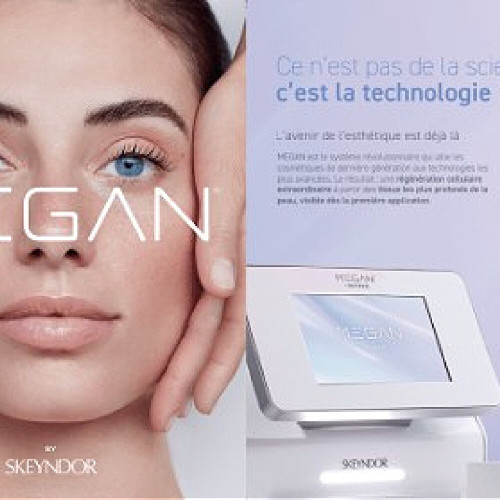 MEGAN Consumer Leaflet Fr
