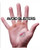 StraightLine Palm Protectors Neoprene Fingerless (pair) StraightLine Palm Protectors Neoprene Fingerless (pair)