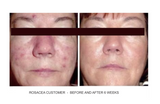 Proven Results! Before and After SBR Regimen at 6 weeks.