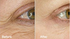 60 Day Before and After Pura Veda Organics Skin Care regimen, including Eye Line Prevention Serum
