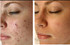 Proven Results! Look what just 4 weeks of using this product can do!