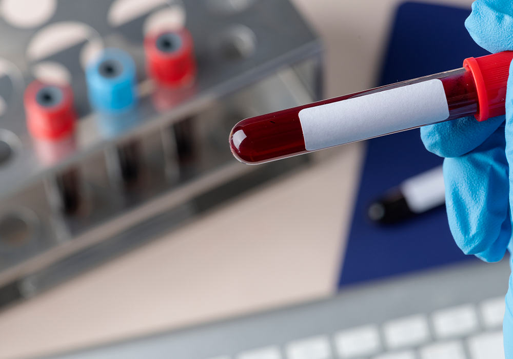 imagen 2 Control de Colesterol y Diabetes