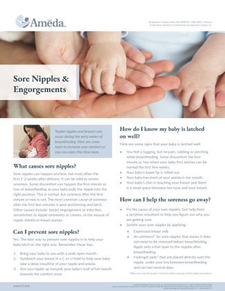 Ameda Sore Nipples & Engorgements 