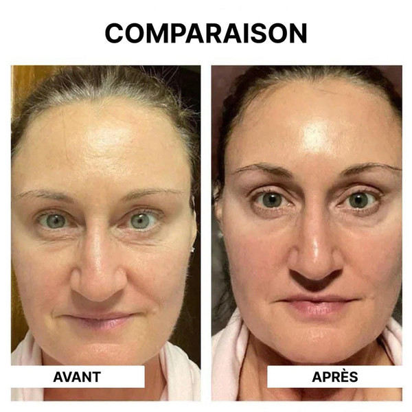 Masque De Collagène Soluble - Healtcare™ Masque De Collagène Soluble - Healtcare™ zaxx