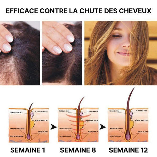 Sérum Pour La Pousse Des Cheveux Au Gingembre zaxx