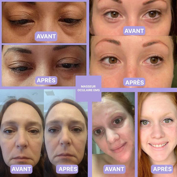 Masseur Oculaire Anti-Cernes zaxx