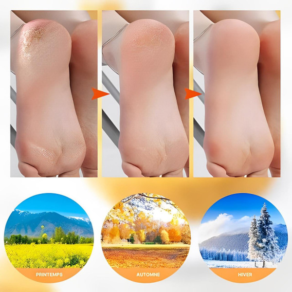 Chaussettes Hydratantes En Silicone Chaussettes Hydratantes En Silicone zaxx
