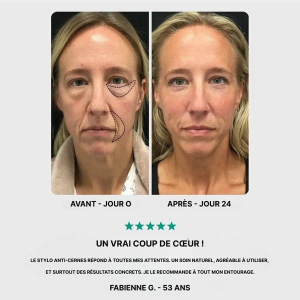 Stylo Anti-Cernes | Appareil Anti-Rides Lifting Visage Stylo Anti-Cernes | Appareil Anti-Rides Lifting Visage zaxx