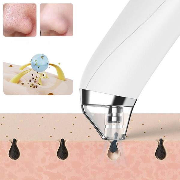 Aspirateur Point Noir - Extracteur Points Noirs Visage Aspirateur Point Noir - Extracteur Points Noirs Visage zaxx