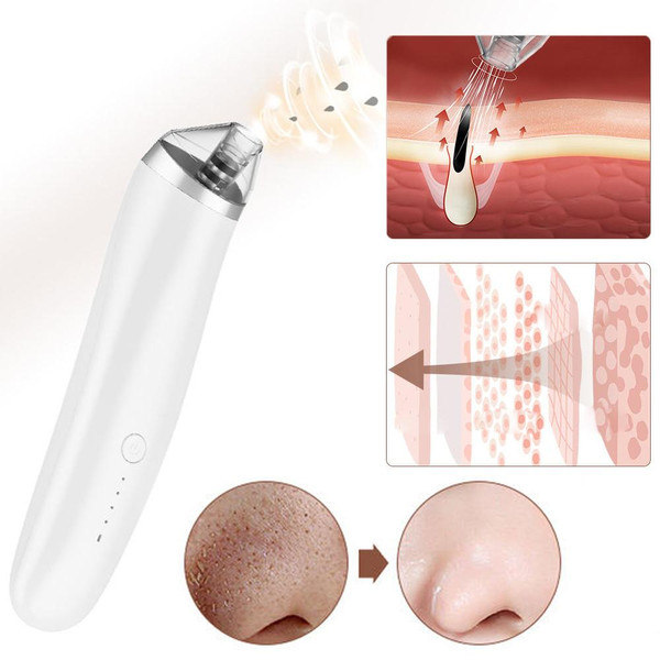 Aspirateur Point Noir - Extracteur Points Noirs Visage Aspirateur Point Noir - Extracteur Points Noirs Visage zaxx