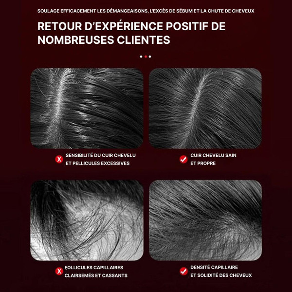 Peigne De Massage Du Cuir Chevelu Peigne De Massage Du Cuir Chevelu zaxx