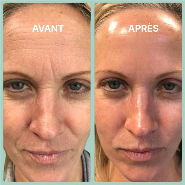 Masque au Bio-Collagène Pour Le Visage Masque au Bio-Collagène Pour Le Visage zaxx