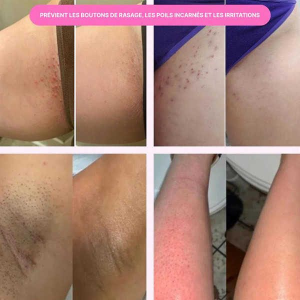 Rasoir Électrique Femme 5-en-1 Maillot Jambes Visage Rasoir Électrique Femme 5-en-1 Maillot Jambes Visage zaxx