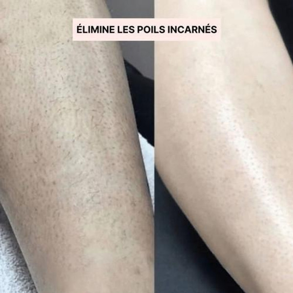 Rasoir Électrique Femme 2-en-1 Rasoir Électrique Femme 2-en-1 zaxx