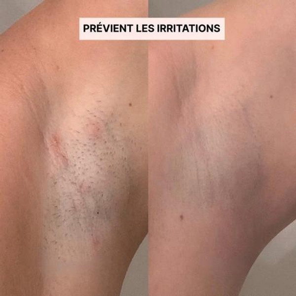 Rasoir Électrique Femme 2-en-1 Rasoir Électrique Femme 2-en-1 zaxx