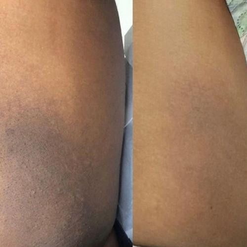 Savon Curcuma Et Acide Kojique zaxx