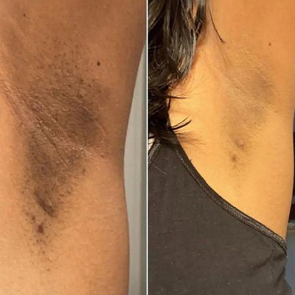 Savon Curcuma Et Acide Kojique zaxx