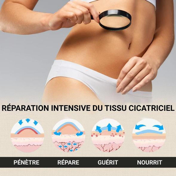 Creme Cicatrisante - Pommade pour Cicatrices - HealthCare zaxx