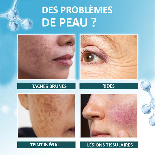 Serum Anti Imperfection et Anti Marque - HealthCare zaxx