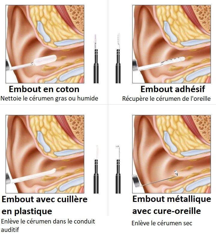 Jean Coutu - EN QUOI CONSISTE UN LAVAGE D'OREILLE? Le lavage ou nettoyage d' oreille consiste à enlever le bouchon de cérumen qui s'est logé dans le  conduit auditif en injectant de l'eau