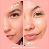 Patchology Bubbly Hydrogel Mask