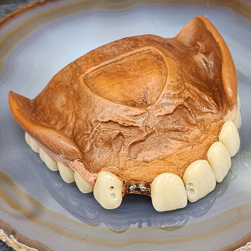 Antique Estate Found Dentures Upper Plate False Teeth w/ Repairs & Additions