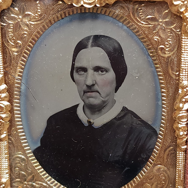 Antique Full Cased 1/6th Plate Ambrotype Photo of Toothless One Eye Blind Woman