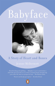 Babyface: A Story of Heart and Bones - ISBN: 9780142000335