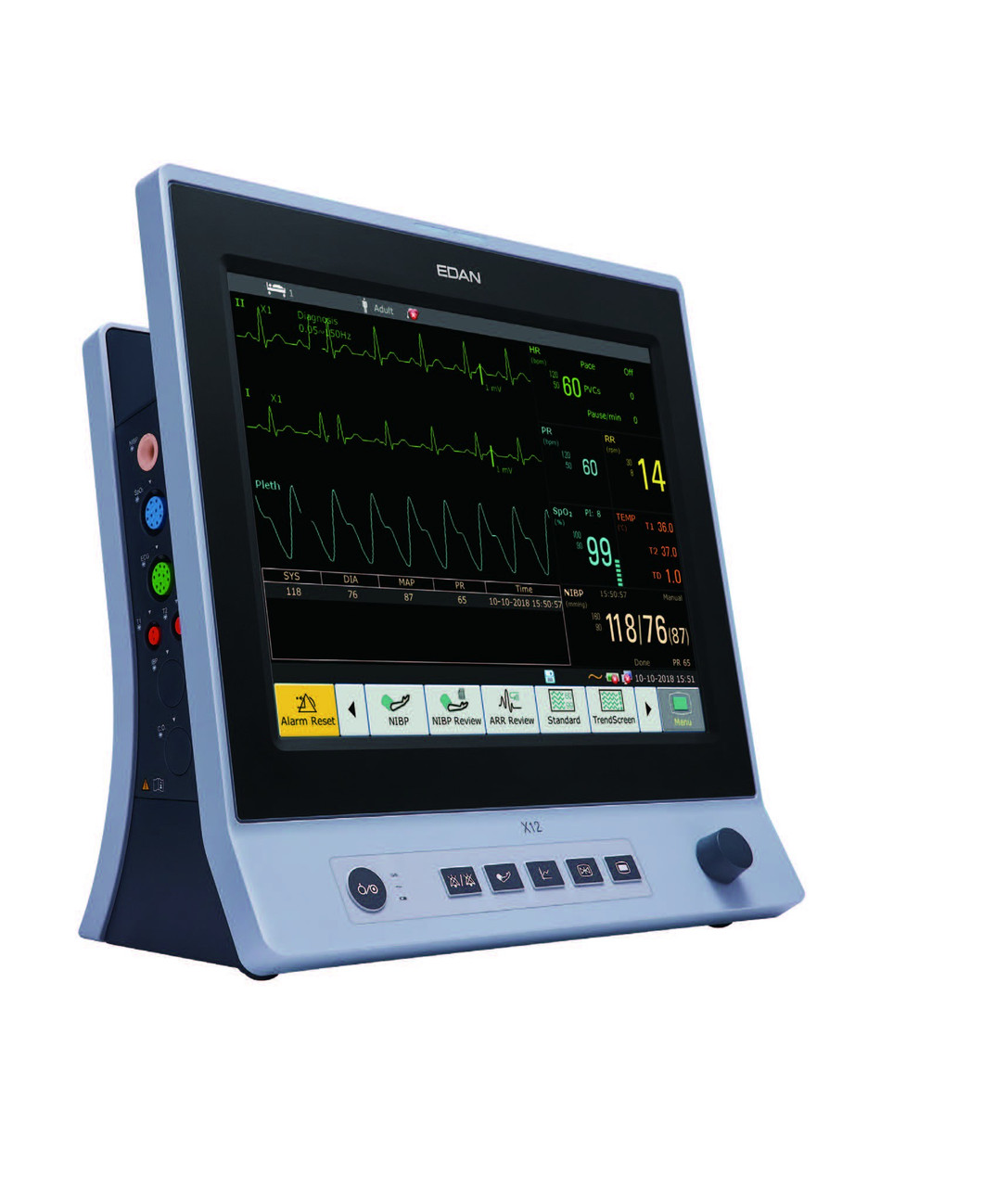 Edan X12 Patient Monitor - Sedation Resource