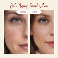 Anti-Aging Facial Lotion  |  Before and After