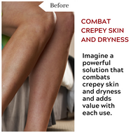 Combat  Crepey Skin and Dryness