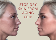 Dry skin doesn’t just feel uncomfortable—it can accelerate the signs of aging!