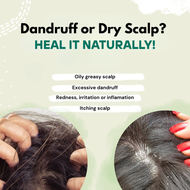Dandruff or Dry Scalp? Heal It Naturally!