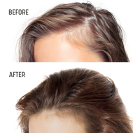 Awaken inactive hair follicles and promote faster hair growth.