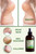 Images of feet in conditions that our serum will help with Images of feet in conditions that our serum will help with