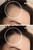 Before and after results on women's hair line