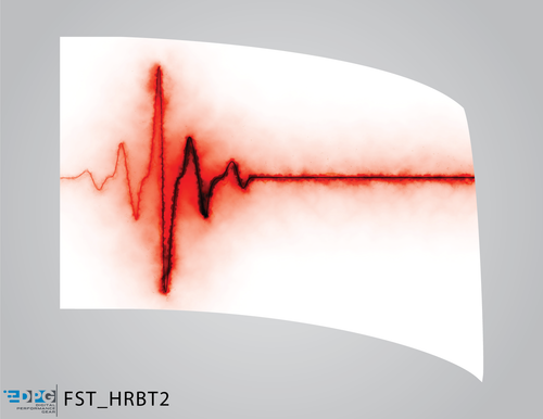 Heartbeat Collection - Standard Flag (FST_HRBT2)