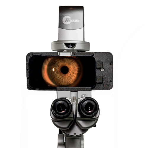 Marco ION Imaging System Screen View