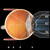 Volk Single-Use 3-Mirror Gonio Lens