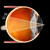 Volk Centralis Direct Lens