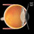 Volk Super Quad 160 Laser Lens